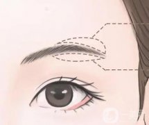切眉手術(shù)后會很快衰老嗎