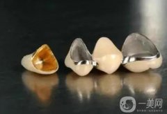 烤瓷牙的壽命怎么延長?烤瓷牙的注意事項(xiàng)？