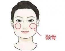 墊高顴骨存在風險嗎，哪些人不適合墊顴骨？