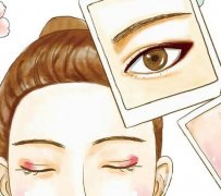 開(kāi)眼角的疤痕消失時(shí)間怎么縮短?