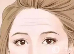 怎么去除抬頭紋才有？