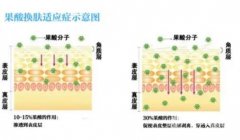 需要多長時(shí)間做一次果酸換膚？