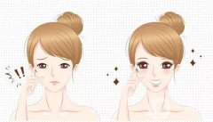 雙眼皮可以做第二次嗎？
