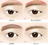 在切眉后眼睛很腫怎么辦？