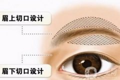 在切眉后多久可以繡眉、畫眉？