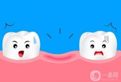 有哪些方法可以延長(zhǎng)種植牙的壽命?