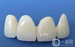 做烤瓷牙需要根管調(diào)節(jié)嗎，需要拔牙？