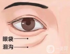 去眼袋手術(shù)適合什么季節(jié)做？