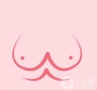 乳暈縮小術(shù)恢復(fù)需要多久？有哪些注意事項(xiàng)？