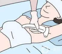 超冰脫毛的價(jià)格受哪些因素影響?