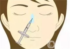 隆鼻具有哪些優(yōu)勢呢?