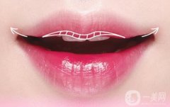 唇外翻矯正術(shù)切除縫合的方法是什么? 唇部外翻矯正后有哪些護(hù)理注意事項(xiàng)?