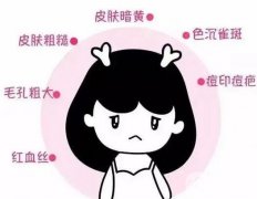 做了光子嫩膚后不能吃什么？