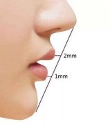 鼻翼縮小有什么后遺癥？如何正確護(hù)理避免?