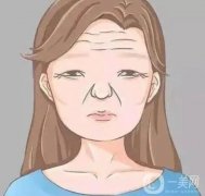 為什么會長抬頭紋？抬頭紋是怎么形成的？