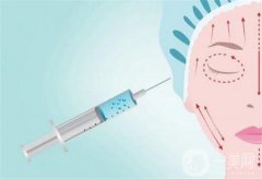 什么因素影響玻尿酸填充淚溝的價(jià)格？