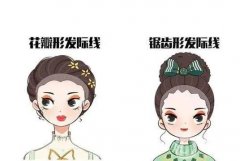植發(fā)后還會掉嗎？植發(fā)后如何減少脫發(fā)？
