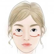磨骨有哪些風(fēng)險，術(shù)后如何護理？