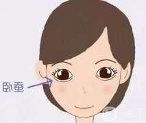 臥蠶需要注射多少玻尿酸？