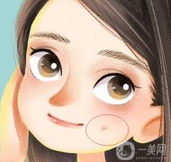 人造酒窩有哪些禁忌癥？