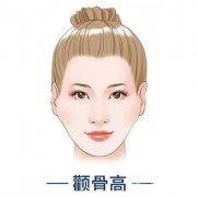 顴骨墊高的果怎么樣？恢復(fù)需要多長時間