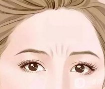如何消除抬頭紋?注意事項(xiàng)？