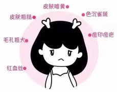 光子嫩膚有哪些作用和優(yōu)勢？