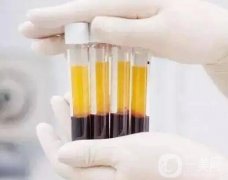 什么是，有什么作用
