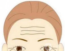 去抬頭紋有哪些方法？