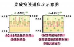 果酸換膚的危害有哪些？