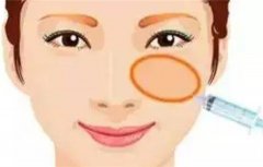 注射美容材料有哪些？