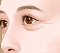 眼部除皺手術(shù)主要有哪些，特點(diǎn)是什么