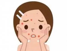 痘坑的成因有哪些？有哪些祛痘坑的方法