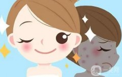 光子嫩膚的性怎么樣？