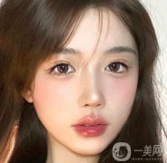 嘟嘟唇整容怎么樣?唇部整容有什么風(fēng)險?