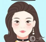 眼袋有哪些類(lèi)型，去眼袋有什么優(yōu)勢(shì)？
