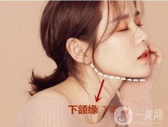 下頜角肥胖的女性整形方法有哪些?下頜角肥胖對臉的影響有多大?