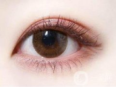三點和埋線雙眼皮信息介紹?選擇埋線還是三點式雙眼皮?