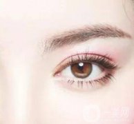 雙眼皮手術(shù)哪種自然? 誰(shuí)不適合割雙眼皮?