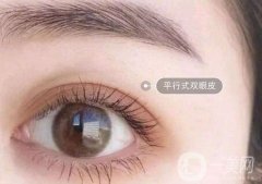 割雙眼皮價(jià)格是多少?割雙眼皮有風(fēng)險(xiǎn)嗎?