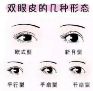 雙眼皮信息介紹?哪種雙眼皮手術(shù)方法適合自己?