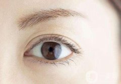 單眼皮怎么變成雙眼皮?雙眼皮手術(shù)的流程是怎樣的?