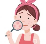 調(diào)節(jié)痤瘡有的方法？