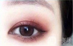 內(nèi)雙可以做雙眼皮手術(shù)嗎?