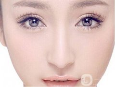 開眼角有嗎?需要多長時間?