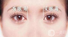 什么樣的眼睛不適合開眼角?