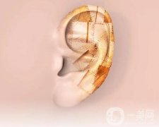 矯正招風(fēng)耳有哪些方法
