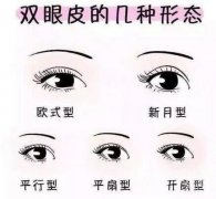 雙眼皮手術(shù)有幾種手術(shù)方法?雙眼皮手術(shù)的恢復(fù)過程是怎樣的?