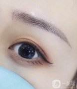 切眉手術(shù)能解決什么問(wèn)題?