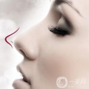 隆鼻多年后需要取出假體嗎?如何選擇適合自己的隆鼻方式?
